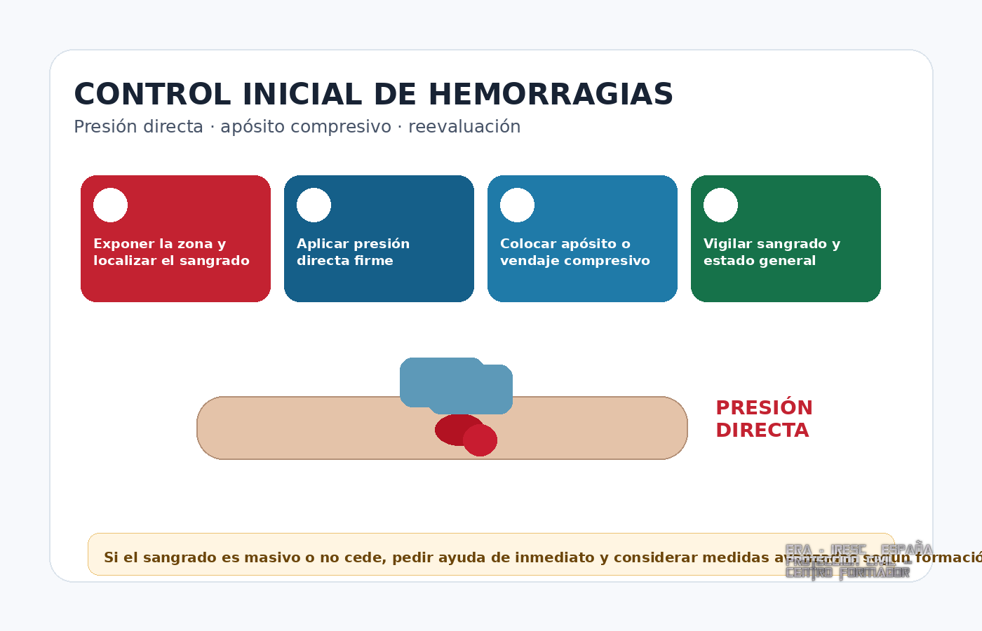 Control inicial de hemorragias con presión directa
